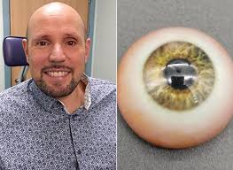 BRITISH NATIONAL GETS WORLD’S FIRST 3D PRINTED PROSTHETIC EYE